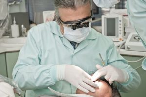 tartar removal